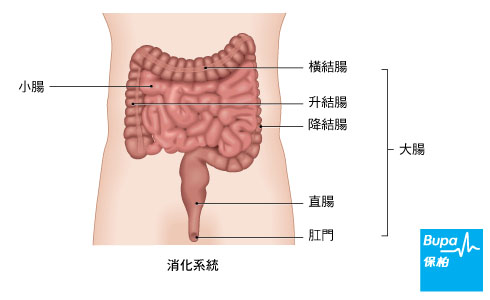 bowel cancer_large-and-small-bowels_chi